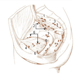 pelvic-lymph-nodes